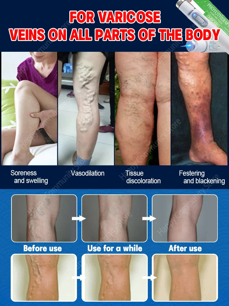Sculpting Secrets Pain Relief + LIPO Belt